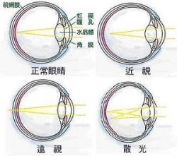 产生散光的原因