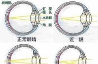 产生<span style=
