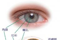 怎样防止视网膜脱落 有什么具体防护措施吗
