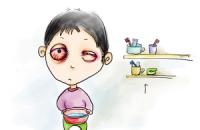 红眼病的症状有哪些 多久能治好