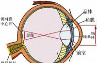 视网膜脱落早期症状表现有哪些